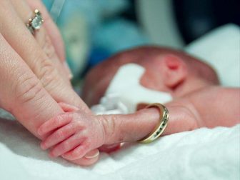 Viêm lợi, viêm nha chu là một trong những nguyên nhân gây sinh non