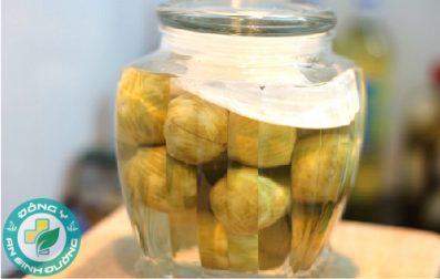 Chữa sâu răng bằng bài thuốc dân gian đơn giản và hiệu quả