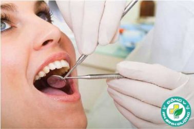 Làm gì để giữ cho răng và nướu khỏe mạnh?