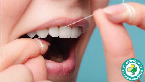 Chỉ nha khoa loại bỏ thức ăn và mảng bám giữa răng và nướu