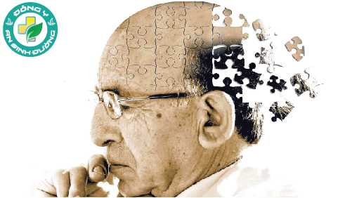 Có mối liên hệ giữa viêm nướu và bệnh Alzheimer