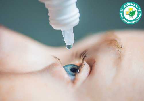 Khô miệng thường đi kèm khô, ngứa mắt và các biểu hiện khác