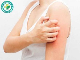 10 nguyên nhân gây ngứa bạn không nên gãi