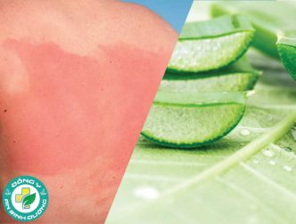 Tinh dầu có thể giúp điều trị cháy nắng