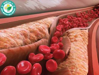13 cách tự nhiên để giảm cholesterol