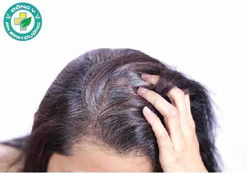 Tỷ lệ tóc của bạn chuyển sang màu xám tăng lên đến 20 phần trăm mỗi thập kỷ sau khi bạn 30 tuổi