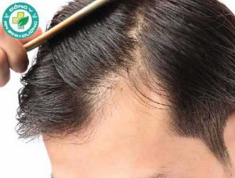 10 cách tốt nhất để kích thích mọc tóc