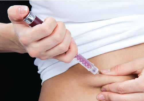 Insulin thường được tiêm vào bụng, nhưng nó cũng có thể được tiêm vào cánh tay trên, đùi hoặc mông